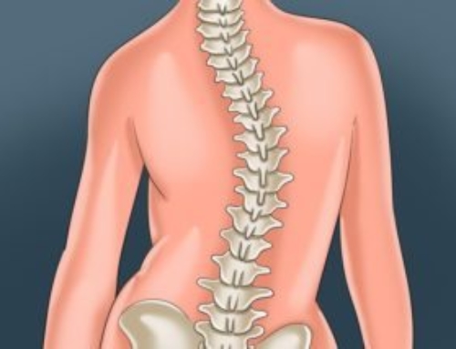4 Benefits of Getting a Scoliosis Screening from a Chiropractor